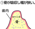 �ǣ£�ˡ