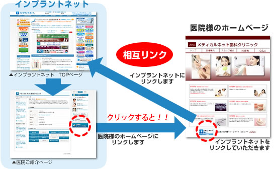 インプラントネットの相互リンクについて