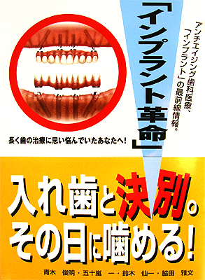 書籍 『インプラント革命』