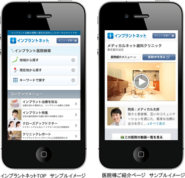 インプラントネット スマートフォンサンプルイメージ
