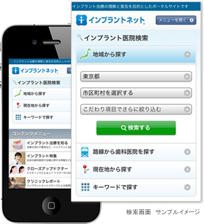 インプラントネット 検索画面サンプルイメージ