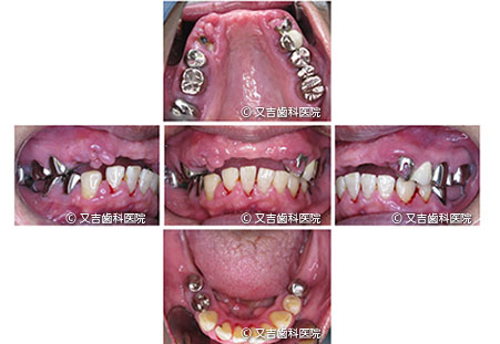 症例1