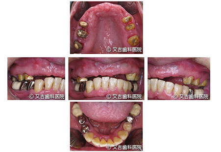 症例1