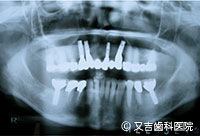 症例1