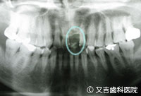 症例2