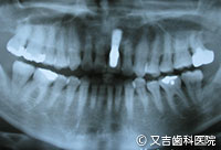 症例1