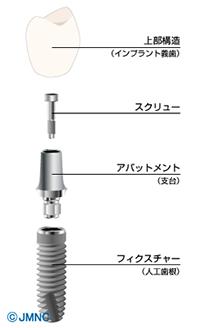 納得・安全の2ピースタイプ