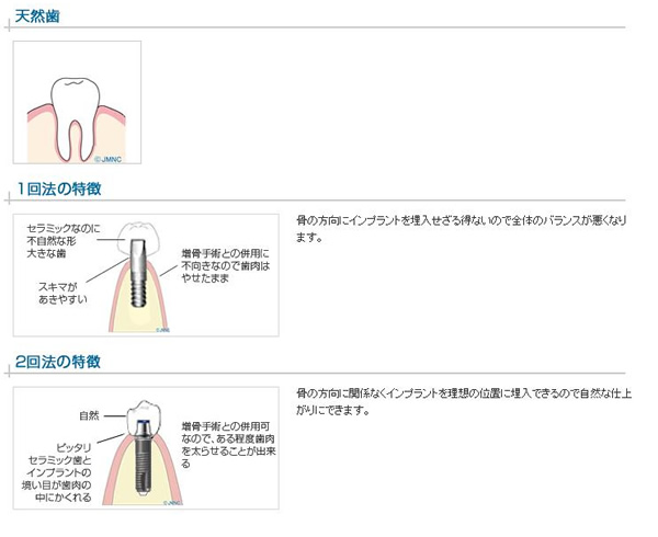 審美的な治療