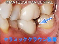 約1週間後チェックを行います