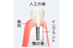 どんな治療をするの?