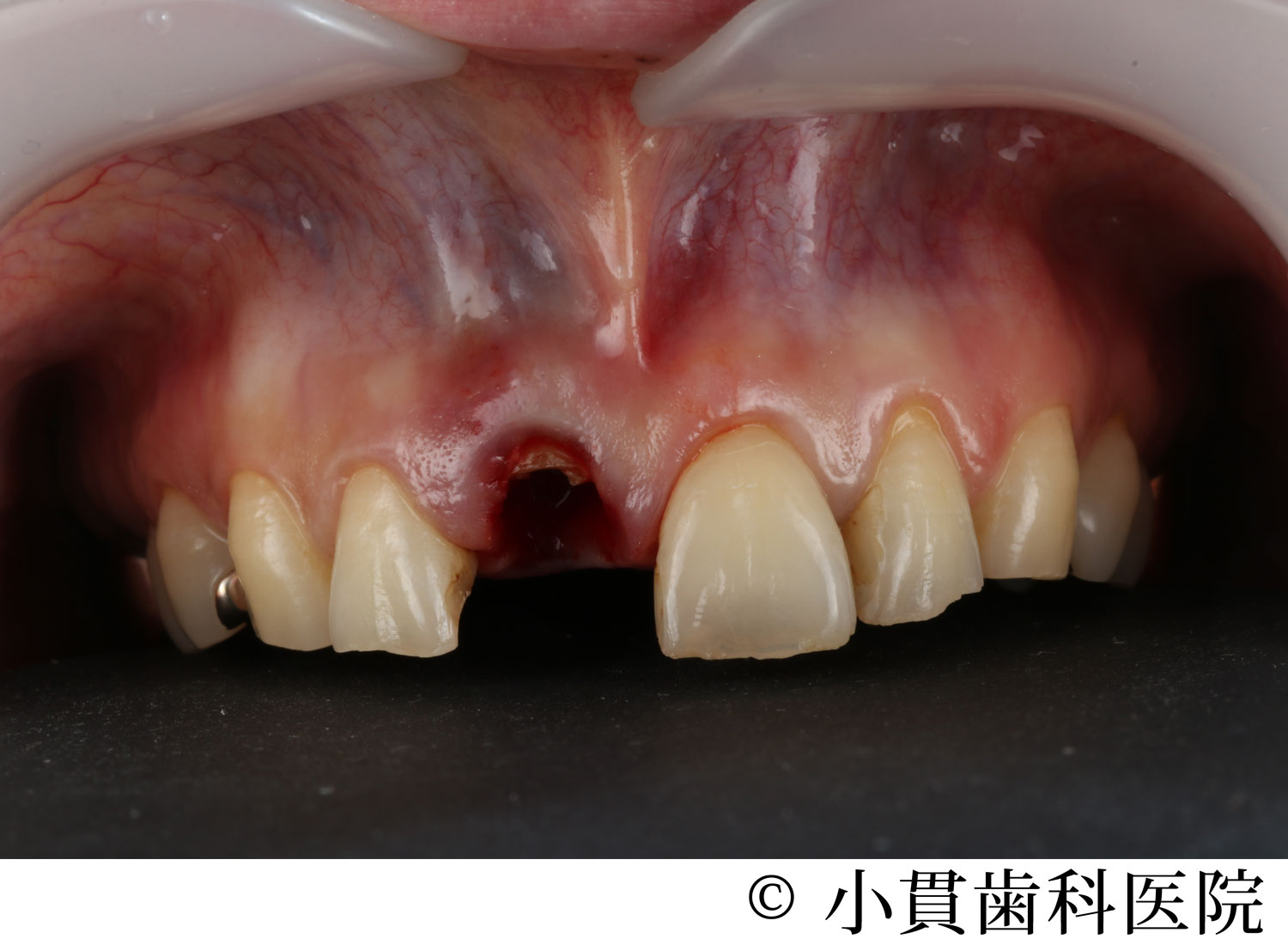 治療前