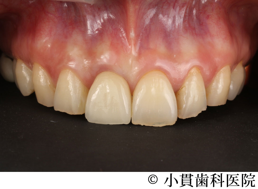 治療後