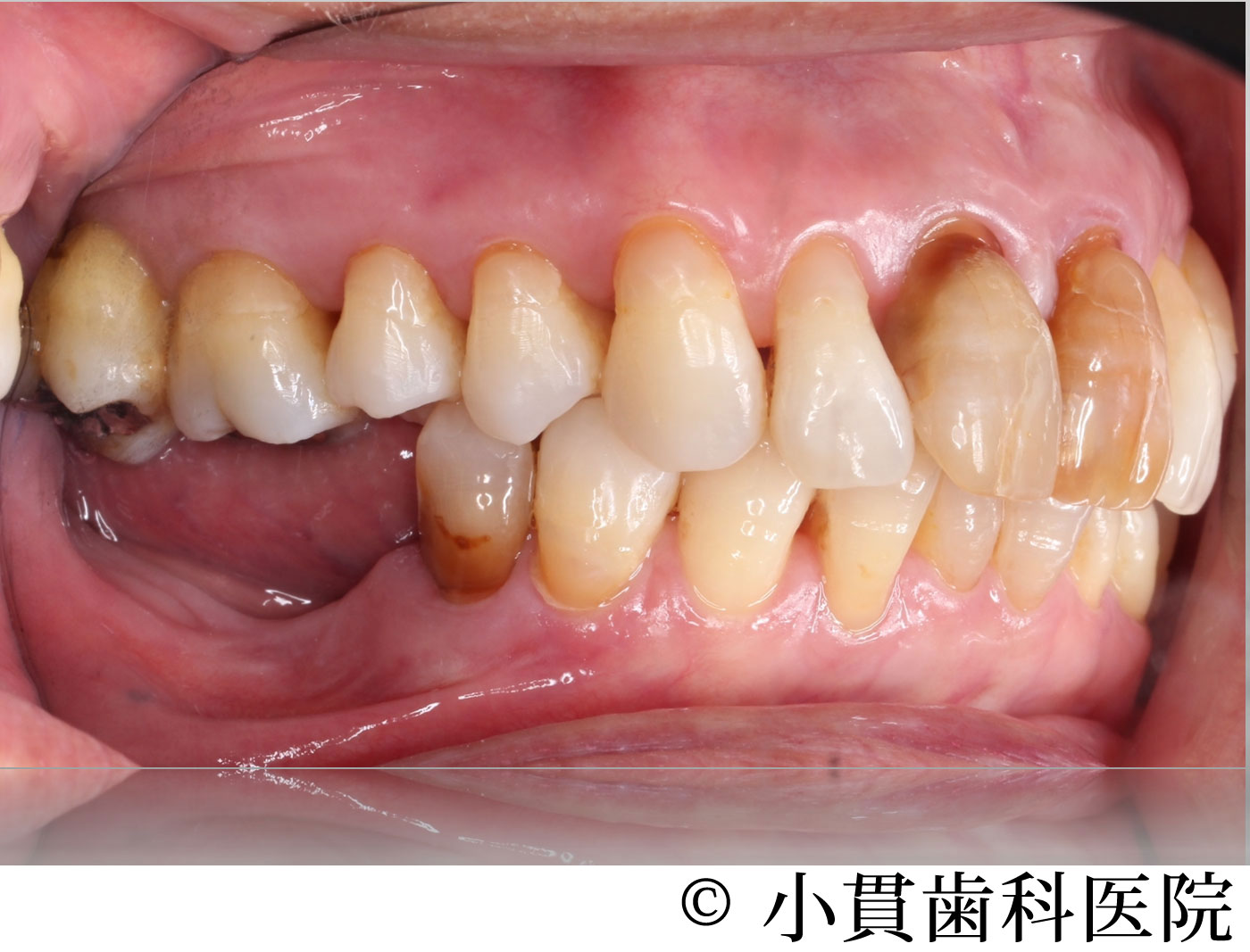 治療前