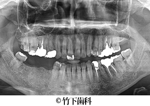 治療前