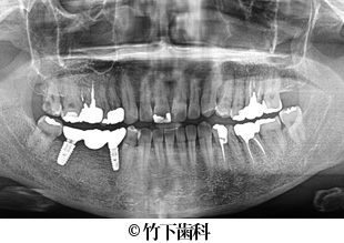 治療後