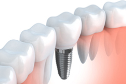 �ǥ����륤��ץ���