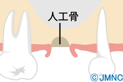 �����åȥ�ե�