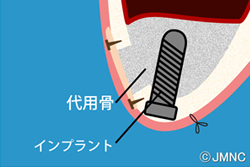 �����ʥ���ե�