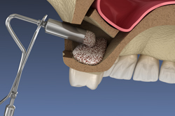 ��¤����Ȥ�ʤ����Ťˤ��б�