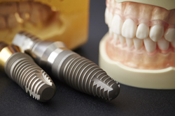 ����ץ���������ѡ�1����ѡ�