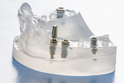 ����ץ���������ѡ�2����ѡ�