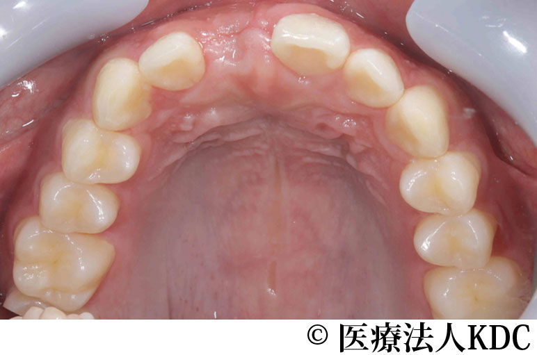 治療前