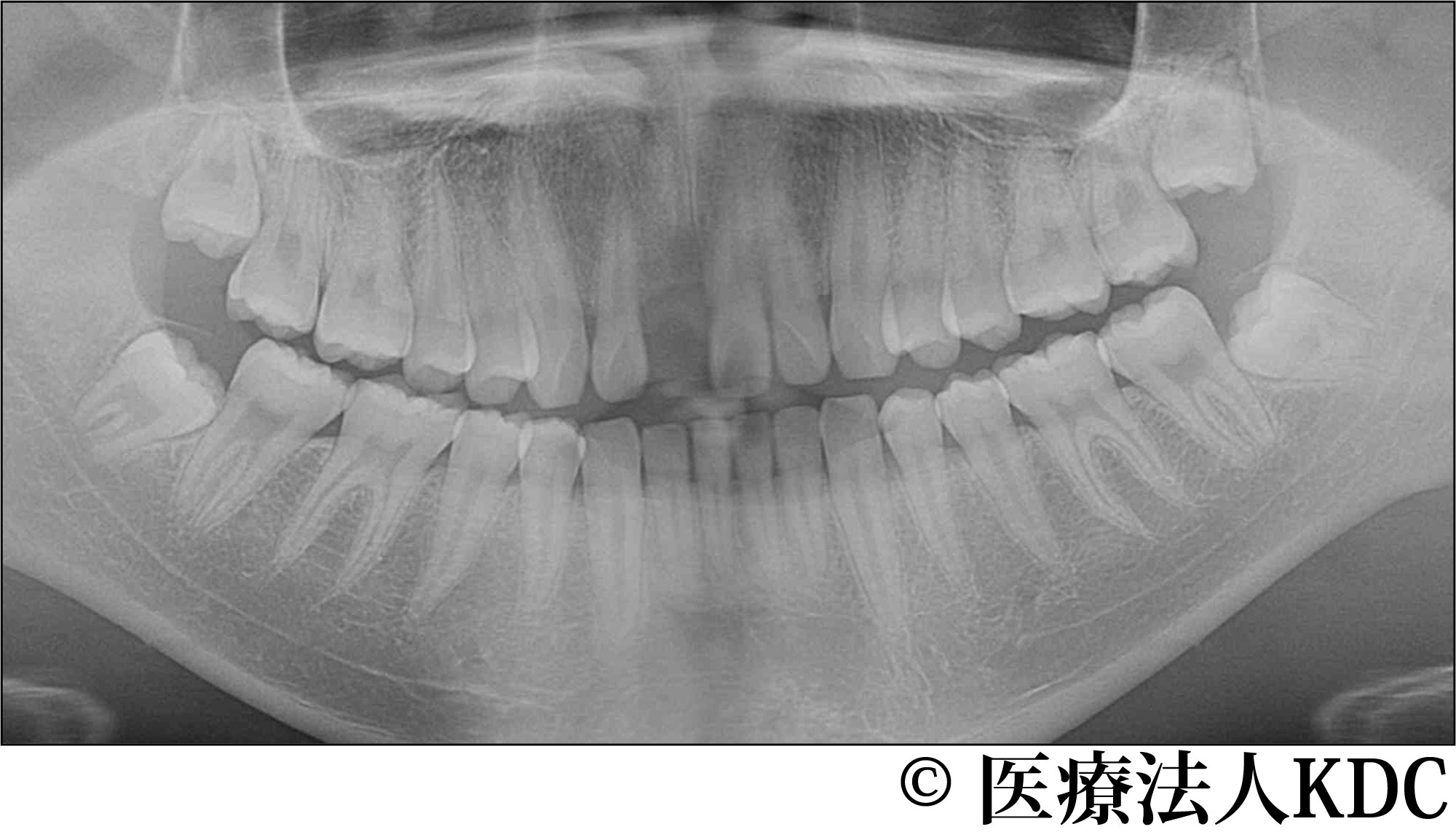 治療前