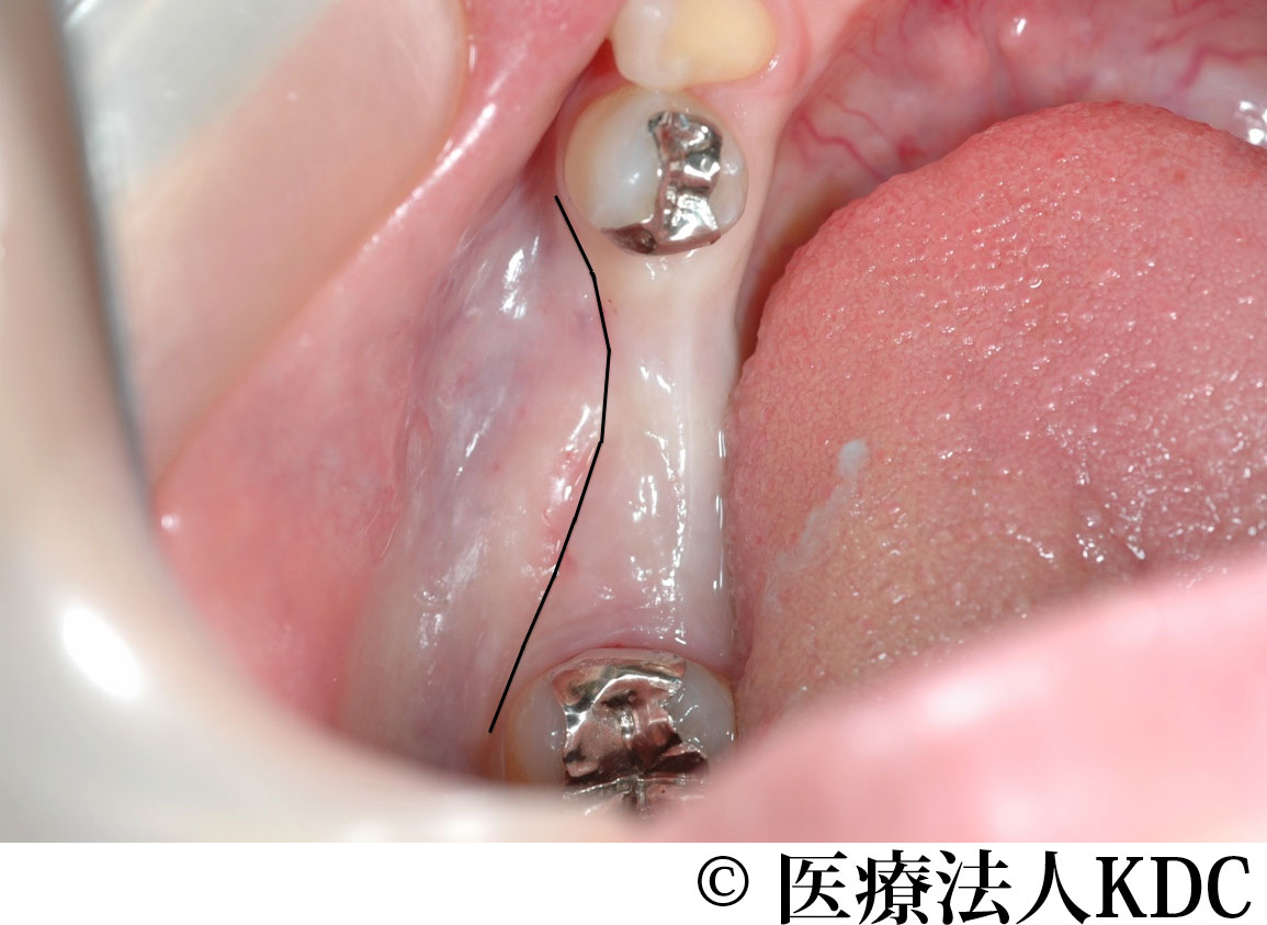 治療前