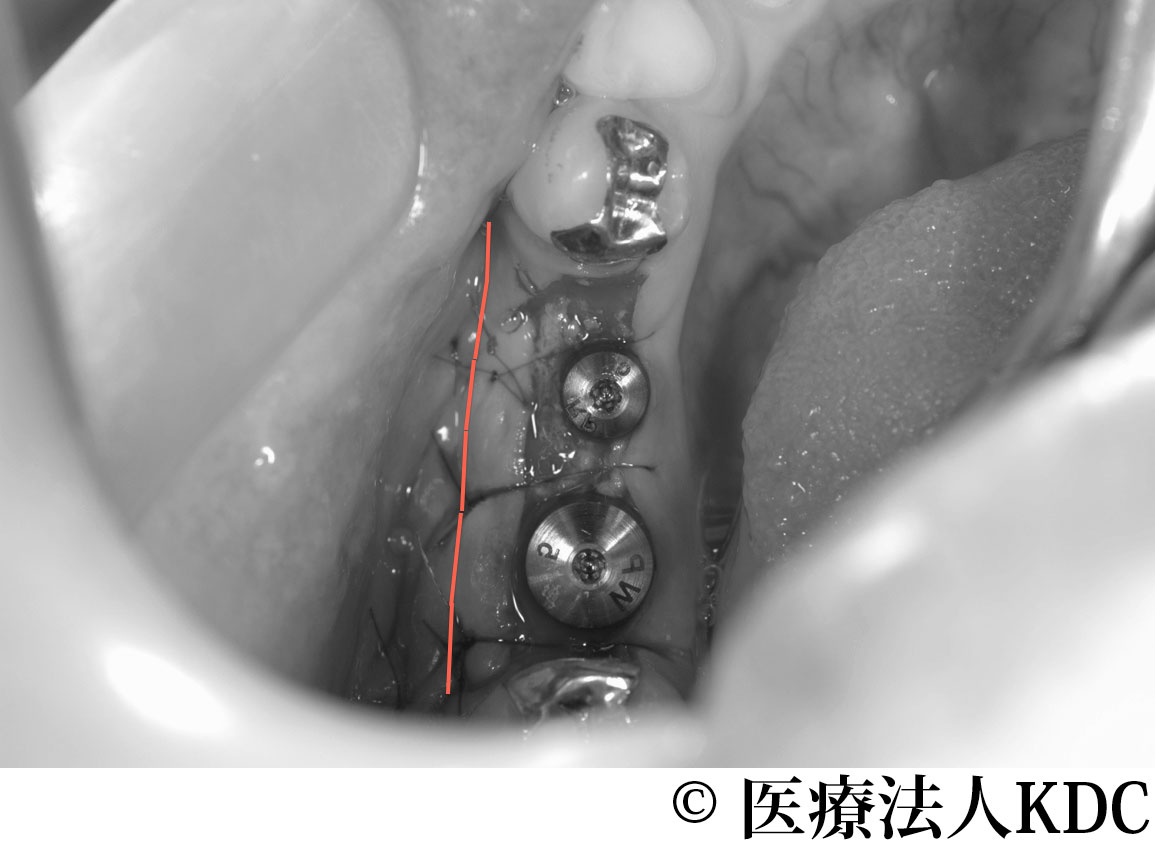 治療前
