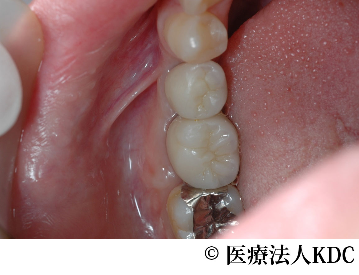 治療前