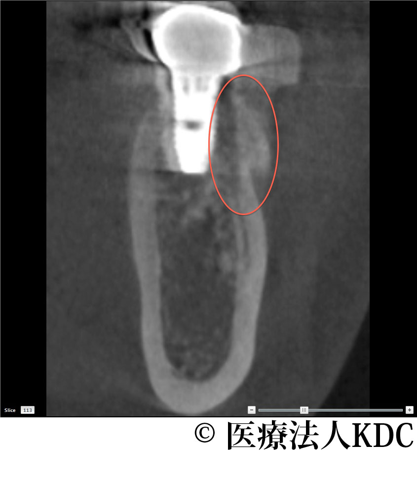 治療前