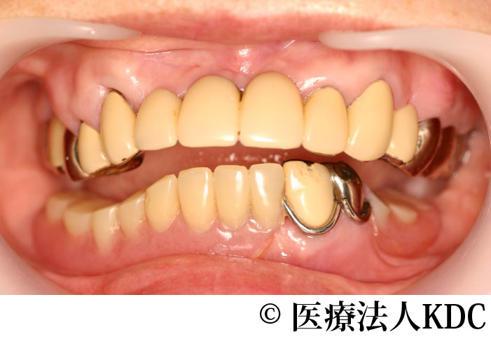 治療前