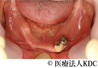 治療前