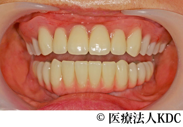 治療前