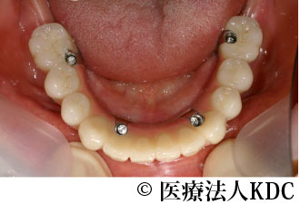治療前