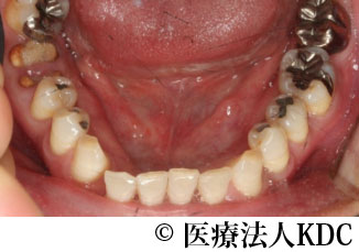治療前