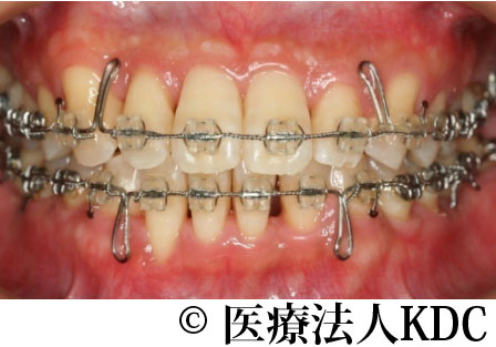 治療前