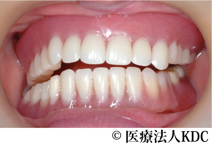 治療前