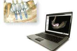 ����ɤ�����ץ��ȼ��ŤΤ����