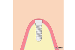 ����ץ��Ȥ��������