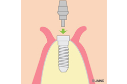 ���Хåȥ��ȡʻ�������ˤμ���դ�