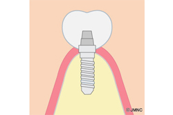 �͹��λ��κ���