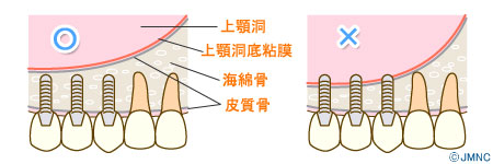 ����ץ��ȼ��Ť�������