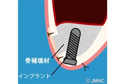 �ڥ����ʥ���եȡ�