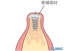 �ڥ��ץ�åȥ��쥹�ȡ�