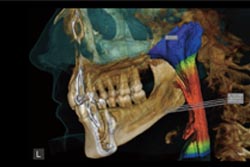 �ܺ٤�3D�����ǳܤι�������ޤ��İ�