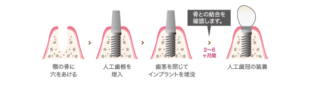 2回法