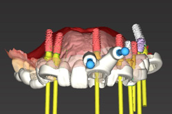�ǥ����뵻�Ѥ���Ѥ�������ץ��ȼ���