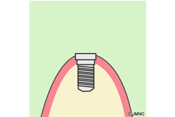 ƬФ2ڡ