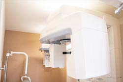 歯科用CTを活用した診断